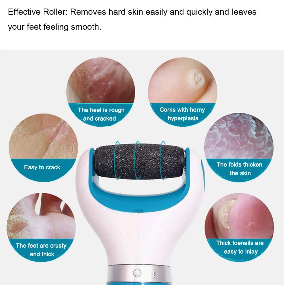 Pedi Hard Skin Remover Rollers for Effective Foot Care - Smarsty