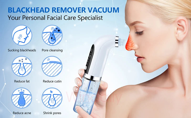 2025 Rechargeable Blackhead Remover Pore Vacuum Cleaner - Smarsty
