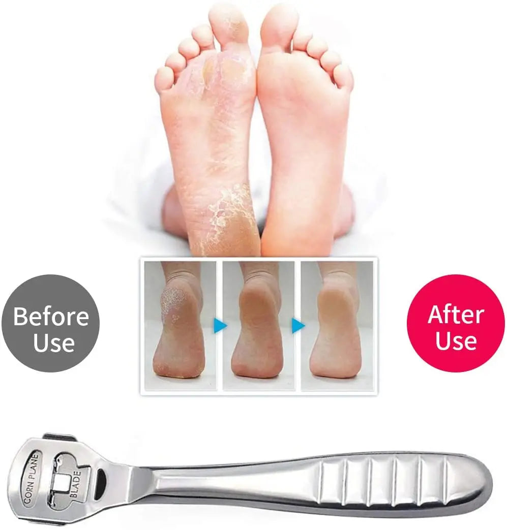 Stainless Steel Foot Callus Shaver for Smooth Skin - Smarsty