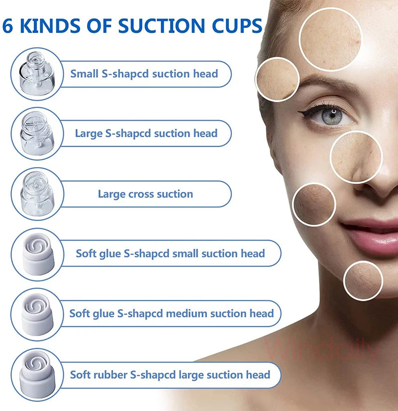 2025 Rechargeable Blackhead Remover Pore Vacuum Cleaner - Smarsty