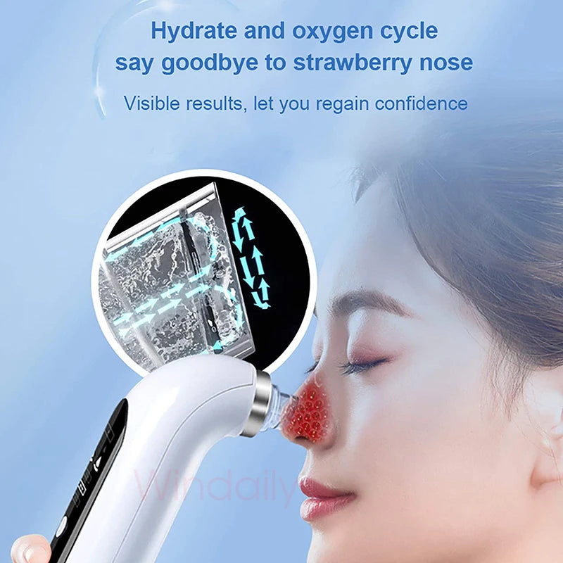 2025 Rechargeable Blackhead Remover Pore Vacuum Cleaner - Smarsty