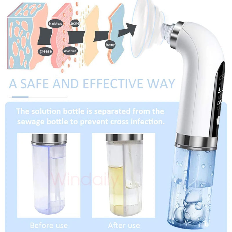2025 Rechargeable Blackhead Remover Pore Vacuum Cleaner - Smarsty