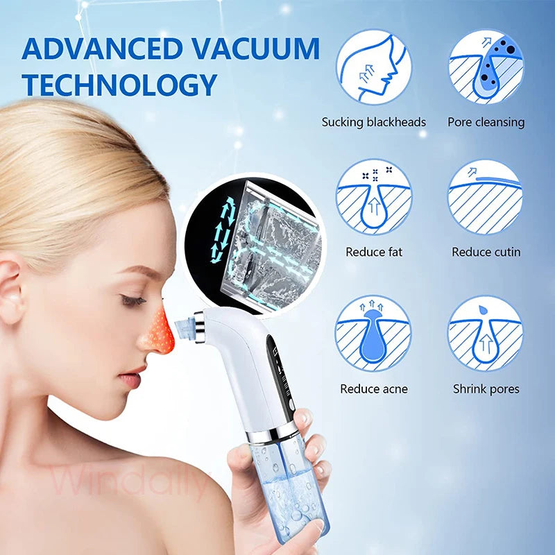 2025 Rechargeable Blackhead Remover Pore Vacuum Cleaner - Smarsty