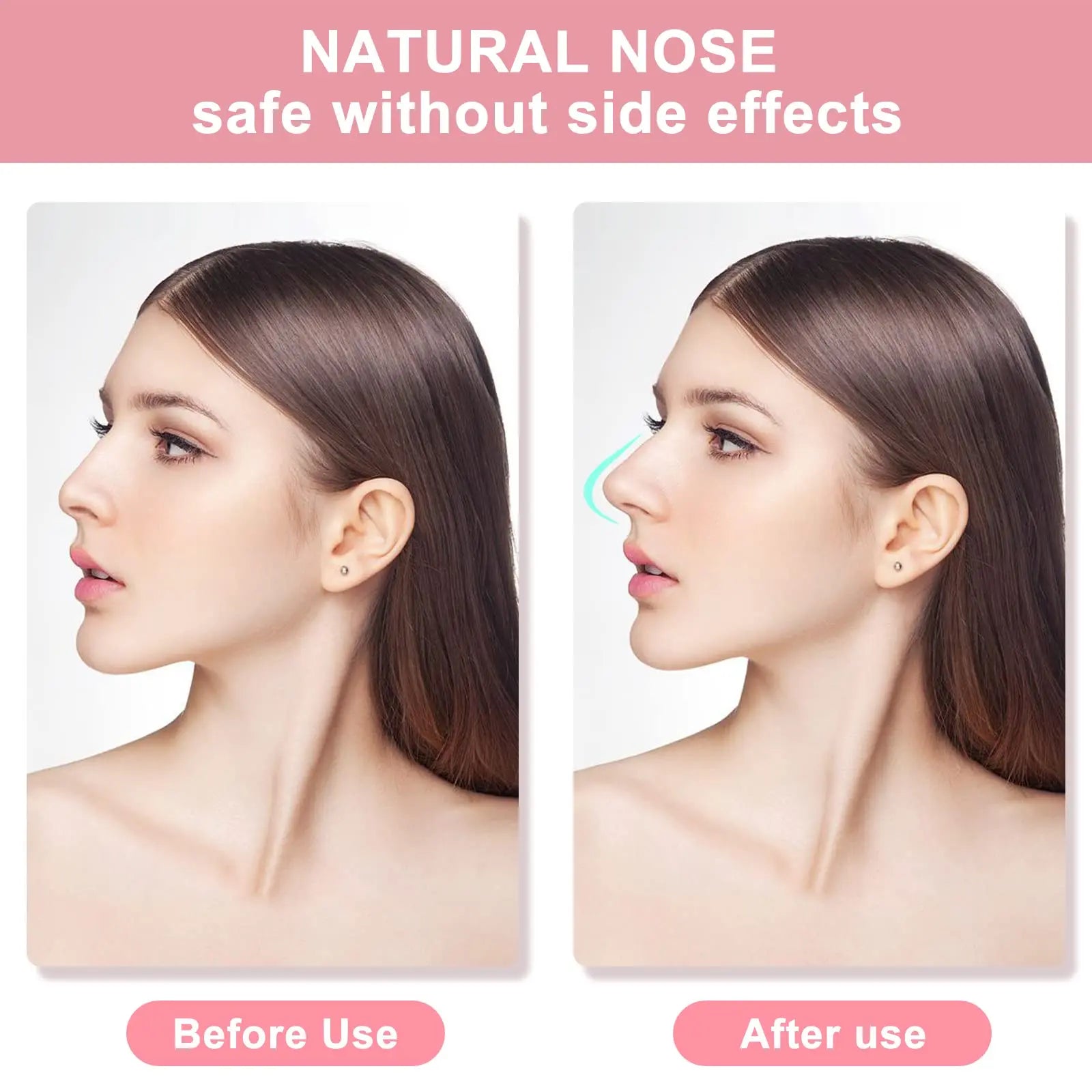 Nose Up Lifting Shaper Clip for Pain Free Slimming - Smarsty