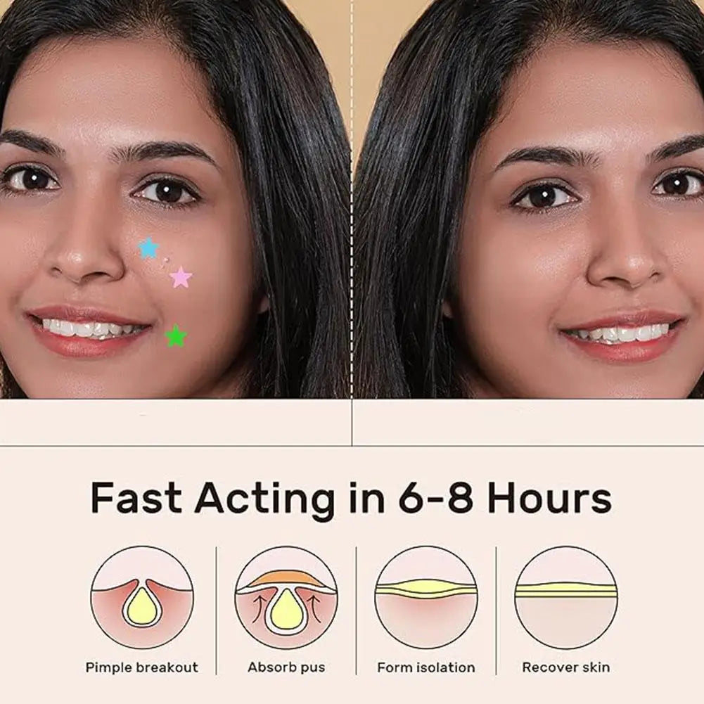 Colorful Star Acne Patches for Spot Treatment - Smarsty