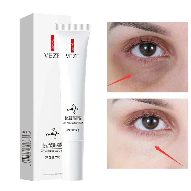 Nicotinamide Eye Cream for Dark Circles and Puffiness - Smarsty