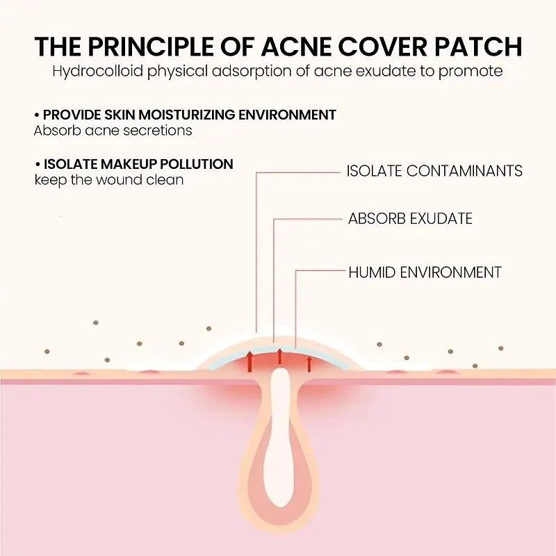 Effective Acne Repair Patch for Fading Blemishes - Smarsty