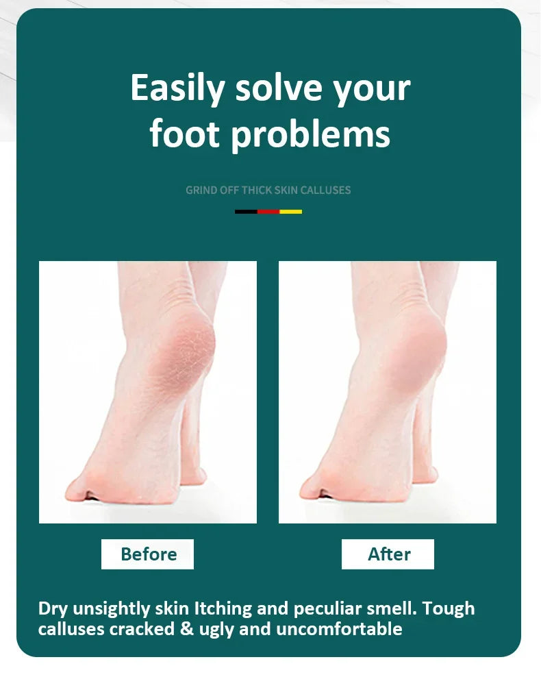 Heavy Duty Foot File for Smooth Callus Removal - Smarsty