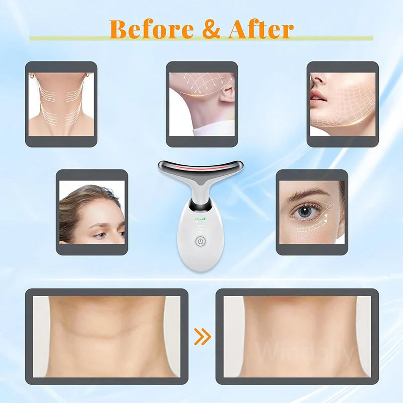 7 Colors Anti Wrinkle Facial Massager for Skin Tightening - Smarsty