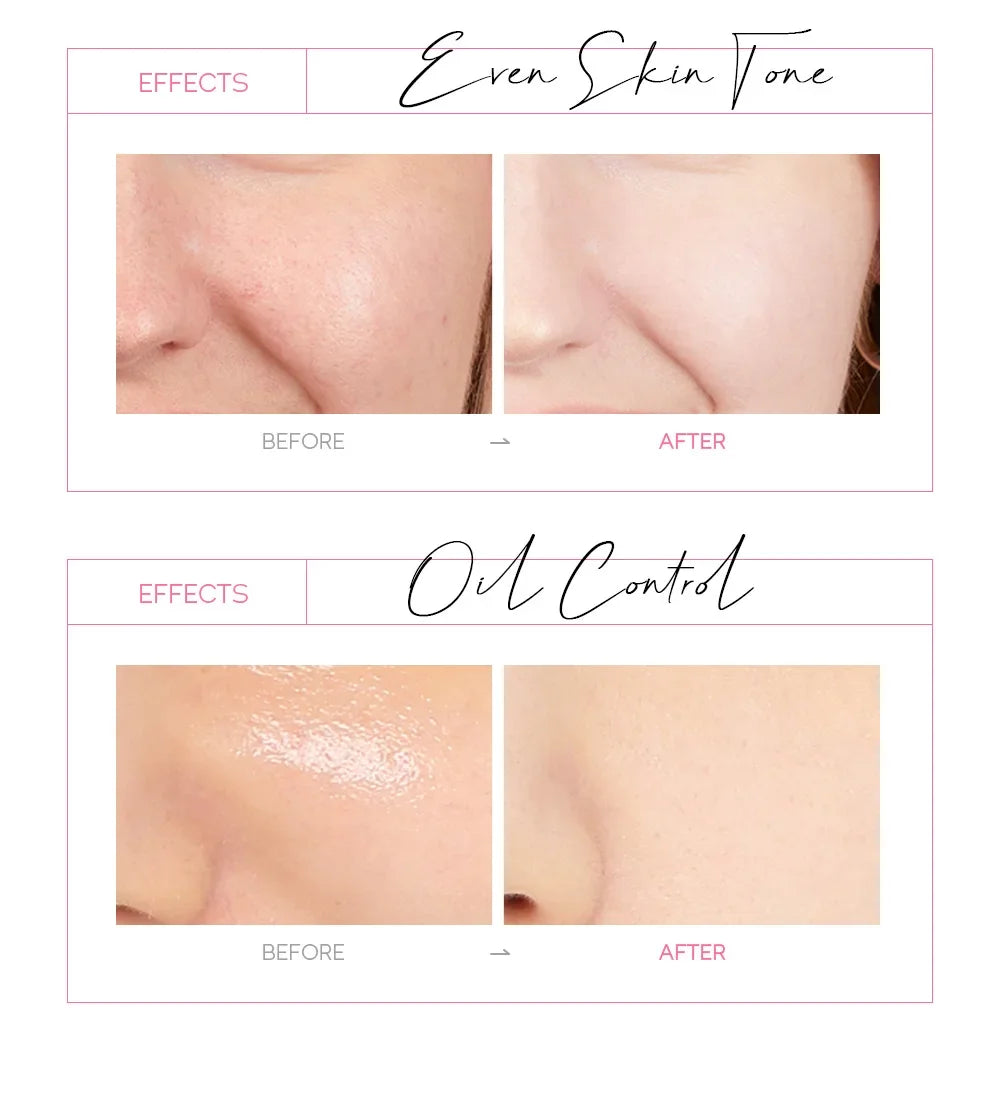 LAIKOU 24K Gold Sakura Peeling Mask for Anti Aging - Smarsty