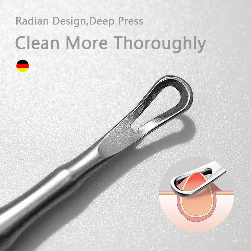 German Blackhead Removal Needle Tool for Clear Skin - Smarsty