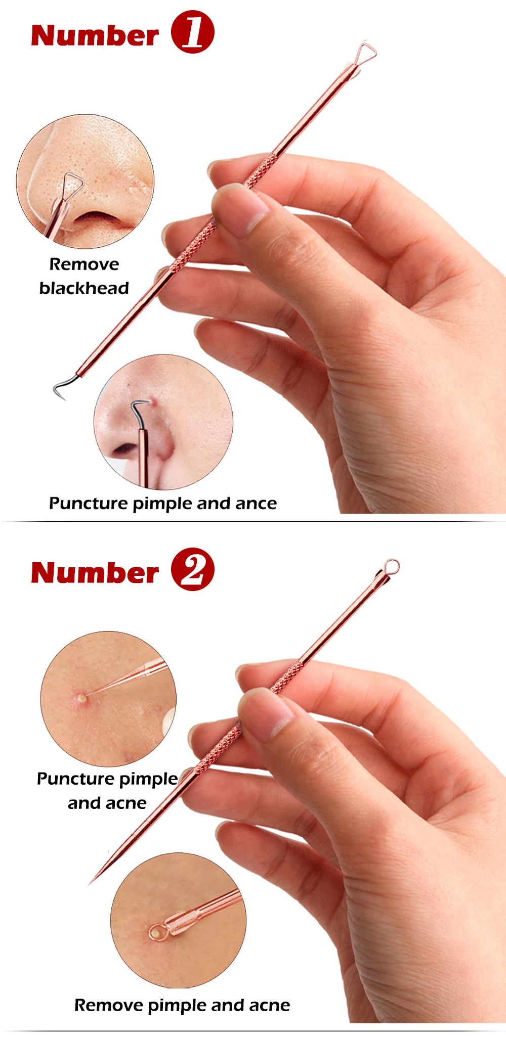 4PCS Acne Blackhead Remover Tool Set for Clear Skin - Smarsty