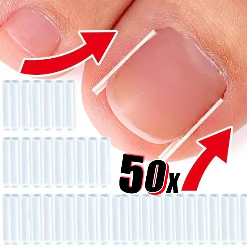 50Pcs Ingrown Toenail Correction Pads for Pain Relief - Smarsty