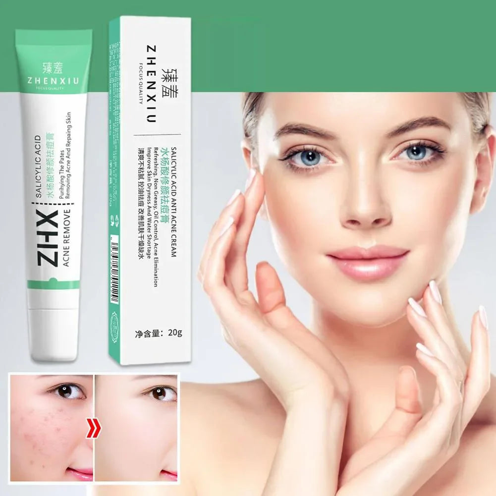 Salicylic Acid Pore Cream for Smooth Skin - Smarsty