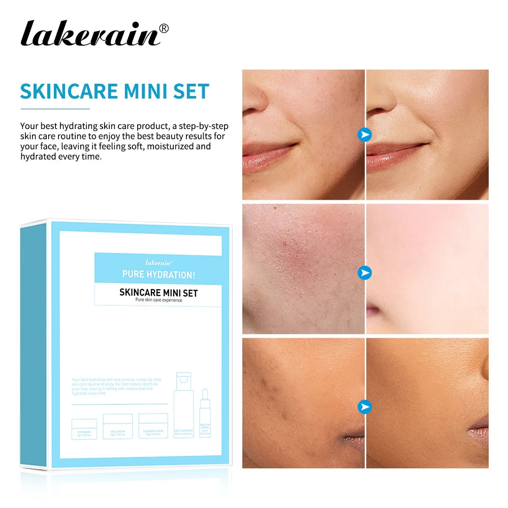 5PCS Skincare Set Hydrate Brighten Firm Skin Exfoliating Acne Removal Shrink Pore Fix Sensitive Dullness Collagen Face Kit