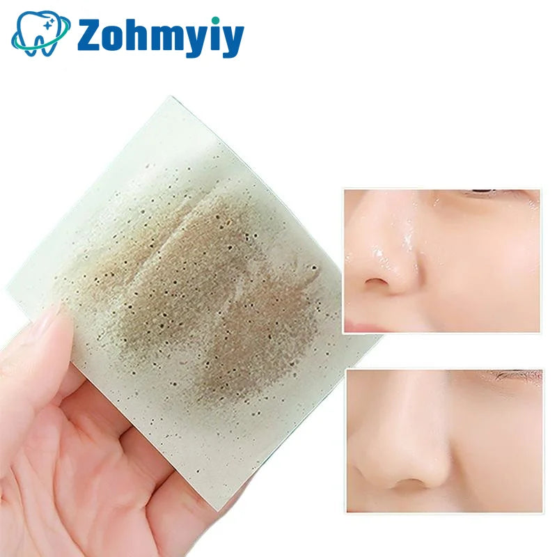 300Pcs Oil Control Blotting Papers for Clean Skin - Smarsty