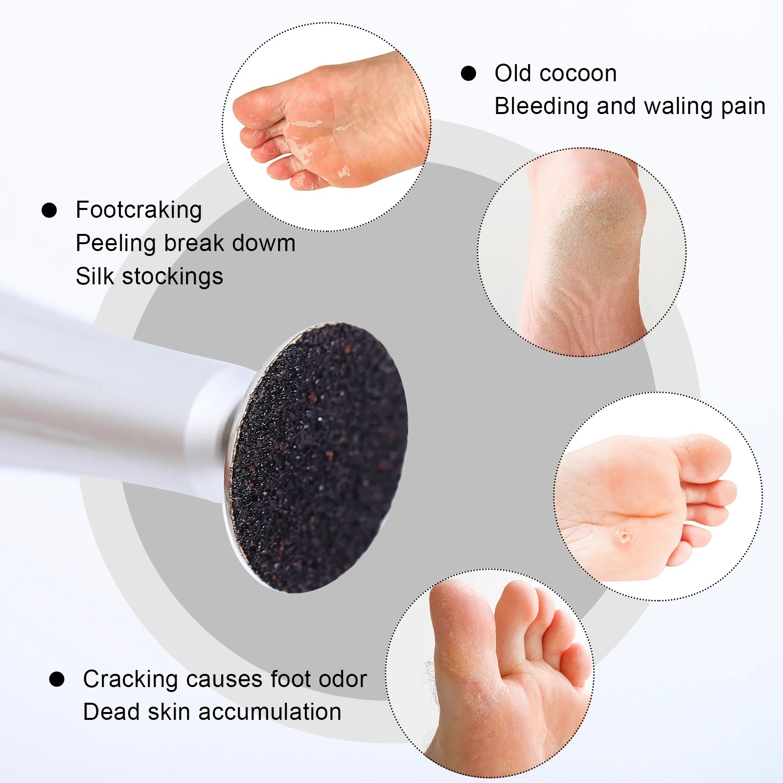 Replaceable Sandpaper Pedicure Discs for Smooth Feet - Smarsty