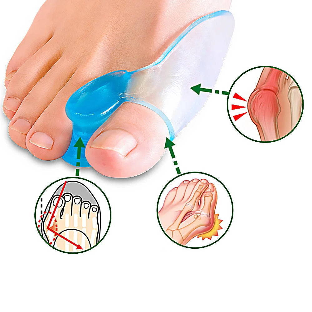 Silicone Toe Separator Gel Bunion Pain Relief - Smarsty