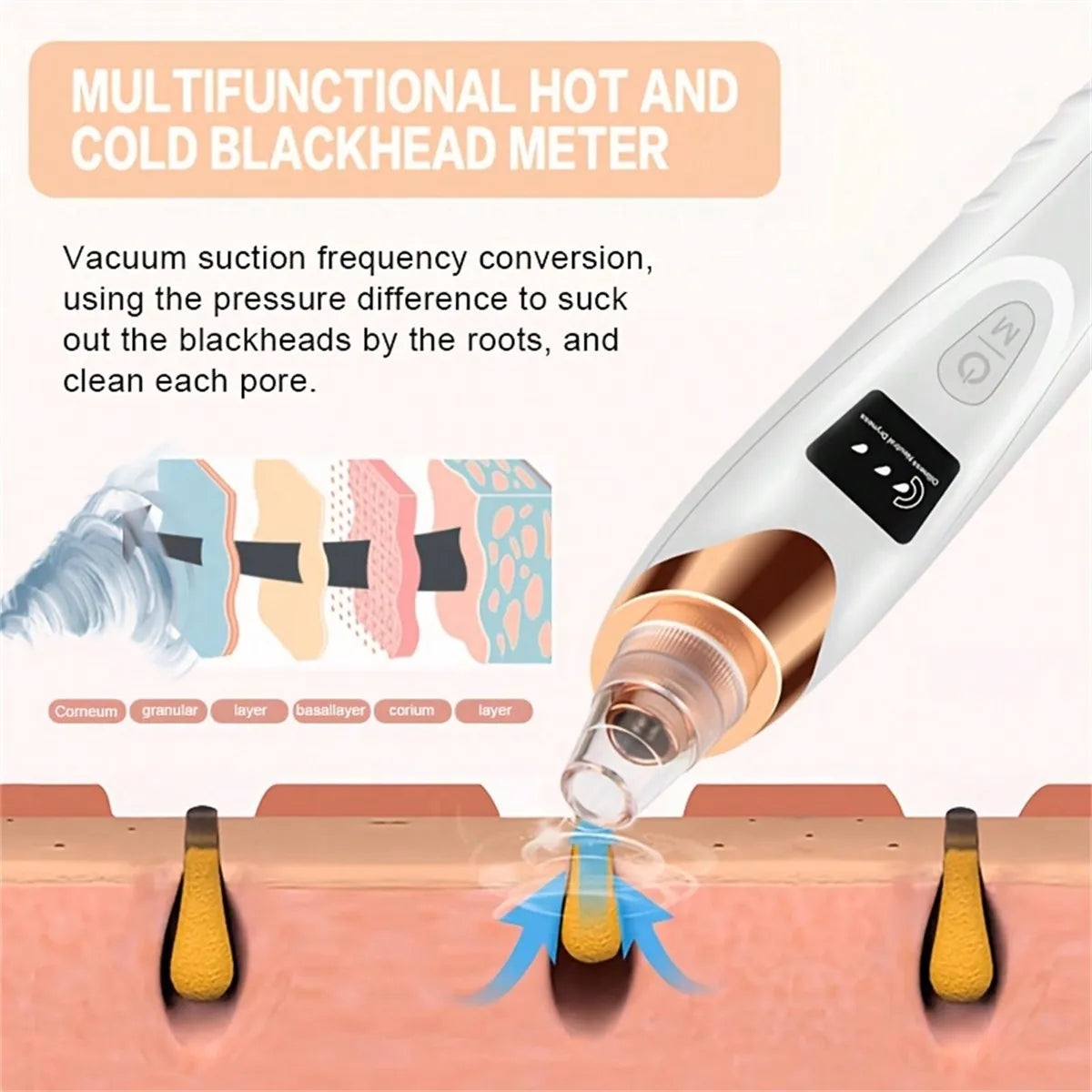 Electric Facial Skin Care Pore Vacuum Blackhead Remover - Smarsty