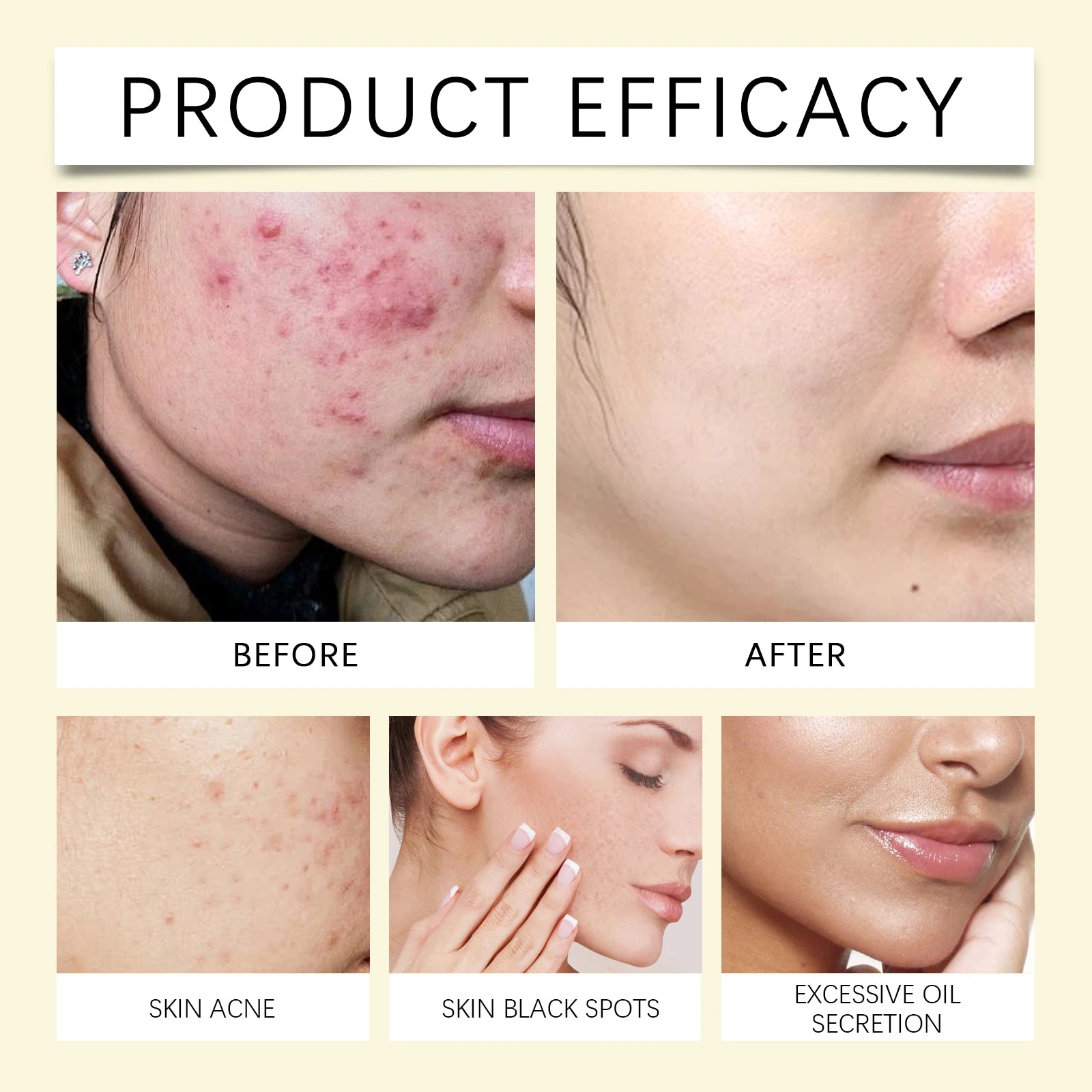 Turmeric Kojic Acid Cleansing Pads for Radiant Skin - Smarsty