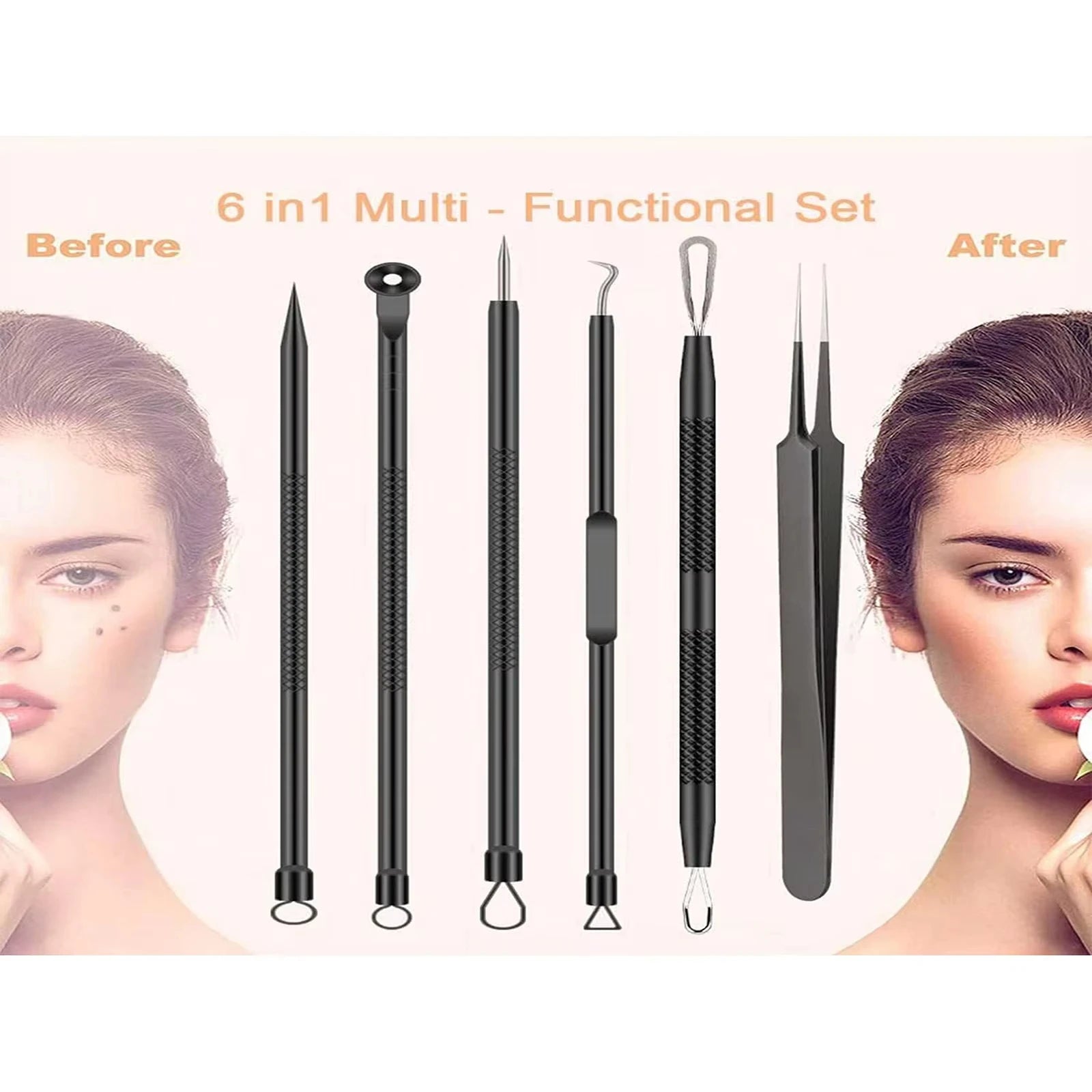 Stainless Steel Acne Removal Tool Set for Clear Skin - Smarsty