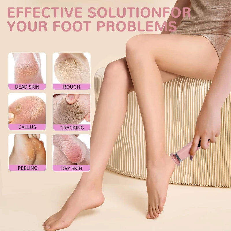 Wireless Electric Foot Callus Remover For Smooth Skin - Smarsty