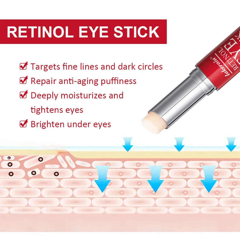 Retinol Eye Cream for Dark Circles and Firming - Smarsty