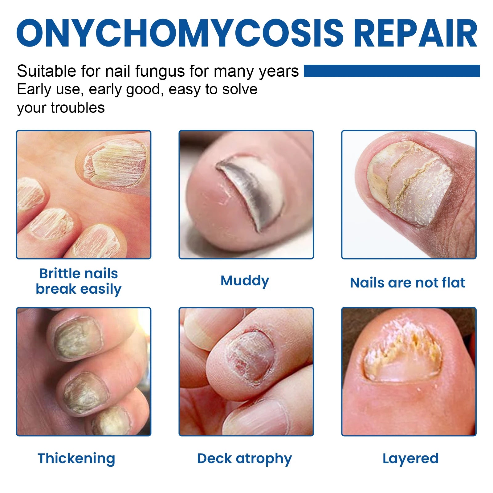 Nail Repair Patches for Toenail Fungus Relief - Smarsty