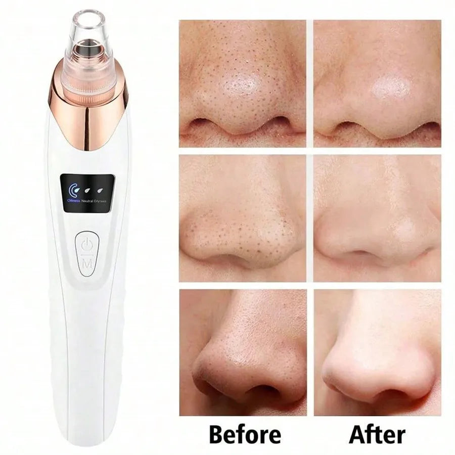 Electric Facial Skin Care Pore Vacuum Blackhead Remover - Smarsty