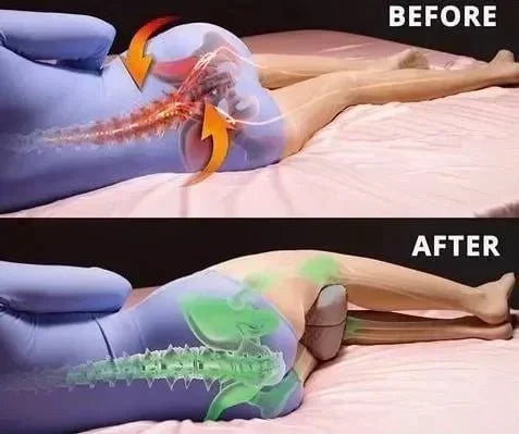 Memory Foam Leg Pillow for Pregnancy and Sciatica Relief - Smarsty