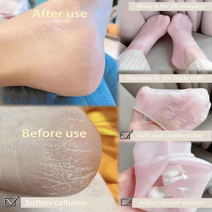 Moisturizing Silicone Foot Socks for Cracked Feet - Smarsty