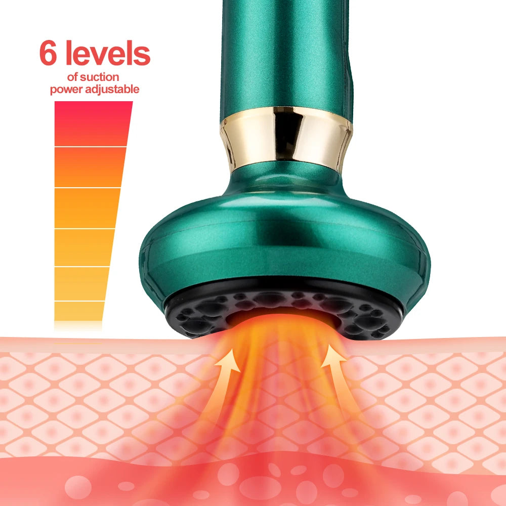 Electric Cupping Massager for Anti Cellulite Body Slimming - Smarsty