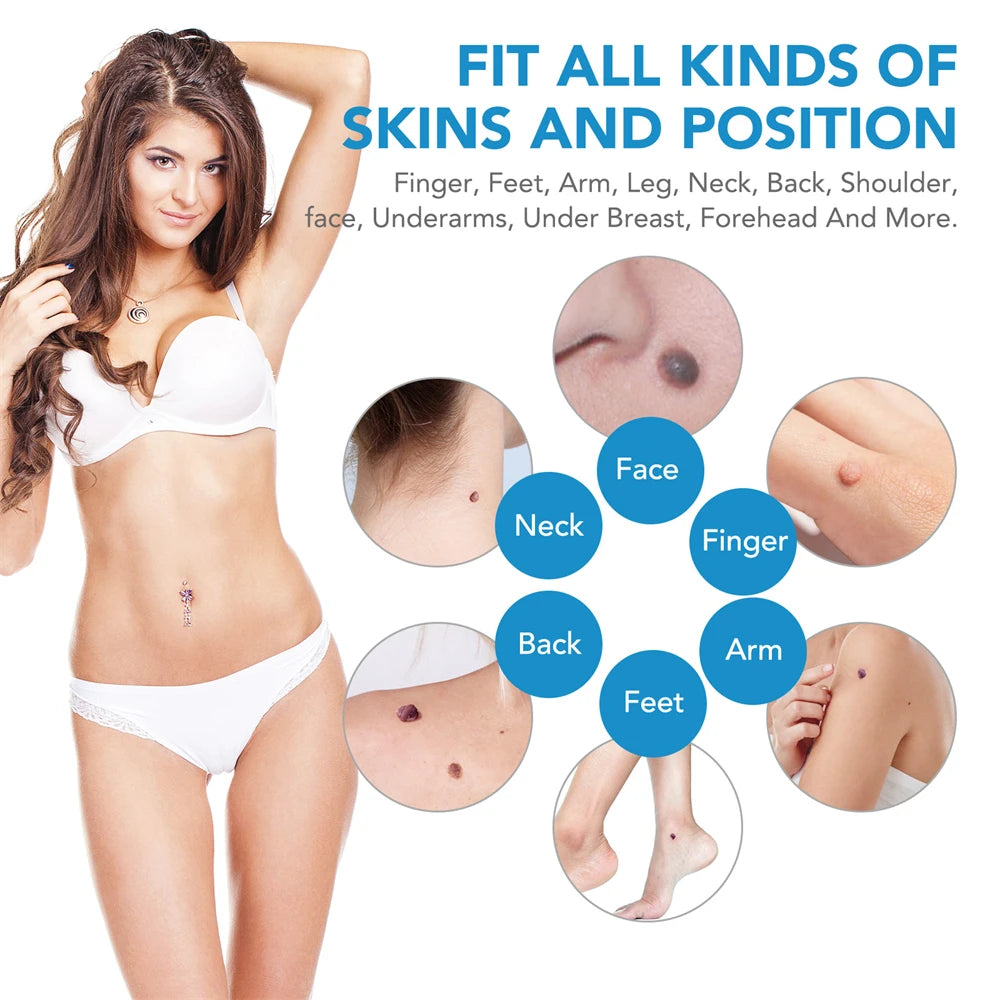 2 in 1 Skin Tag Remover Kit for Effective Face Care - Smarsty