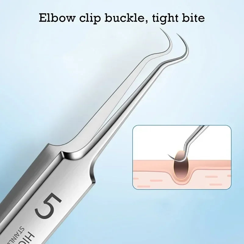 German Ultra Fine Blackhead Remover Tool for Clear Skin - Smarsty