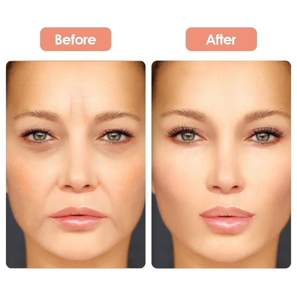 Reusable Anti Wrinkle Silicone Patches for Youthful Skin - Smarsty