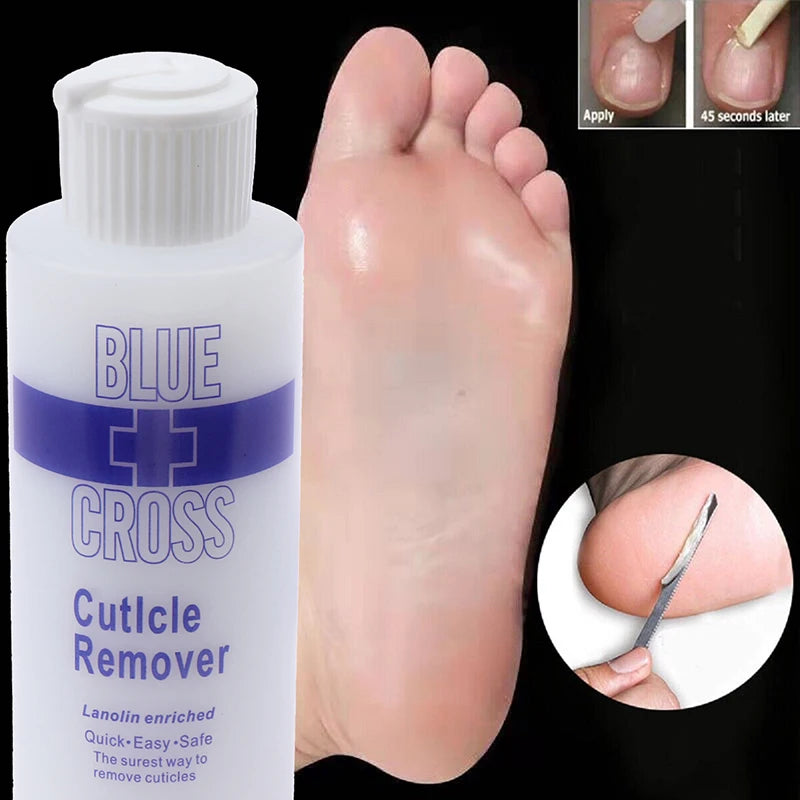 Foot Exfoliator and Callus Remover for Soft Skin - Smarsty
