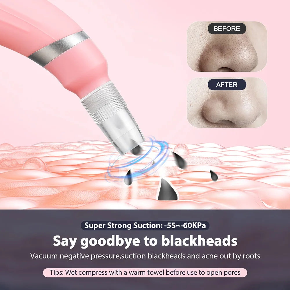 Professional Diamond Microdermabrasion Machine for Home Use - Smarsty