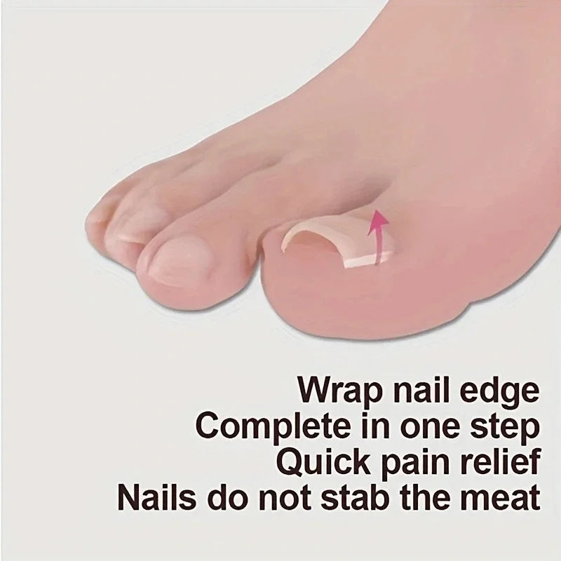 Ingrown Toenail Correction Tool with Elastic Patch - Smarsty