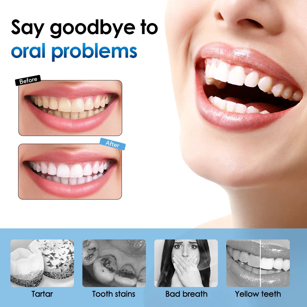 Electric Toothbrush with Sonic Whitening Technology for Plaque Removal - Smarsty