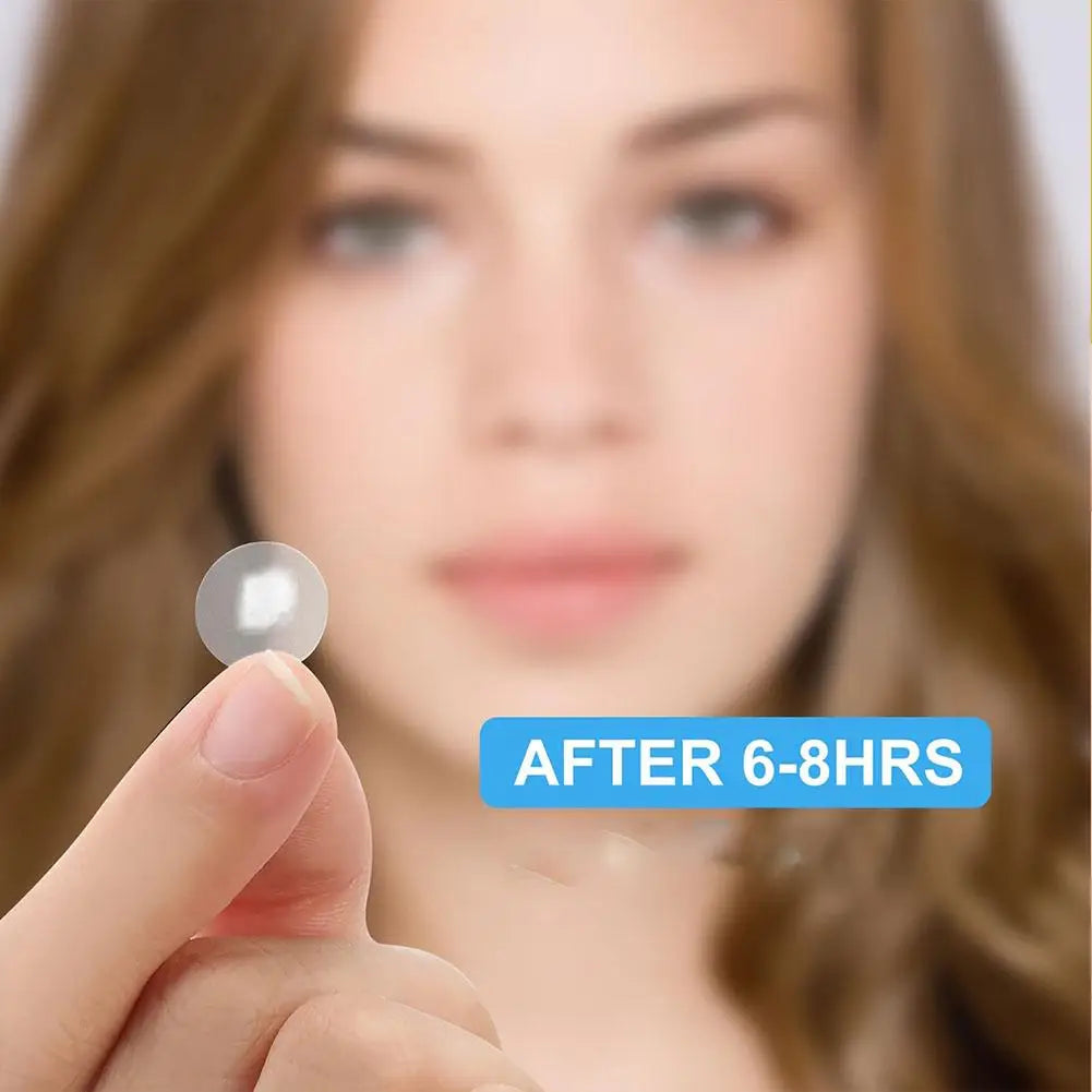 360 Pcs Colorful Hydrocolloid Acne Patches for Quick Healing - Smarsty