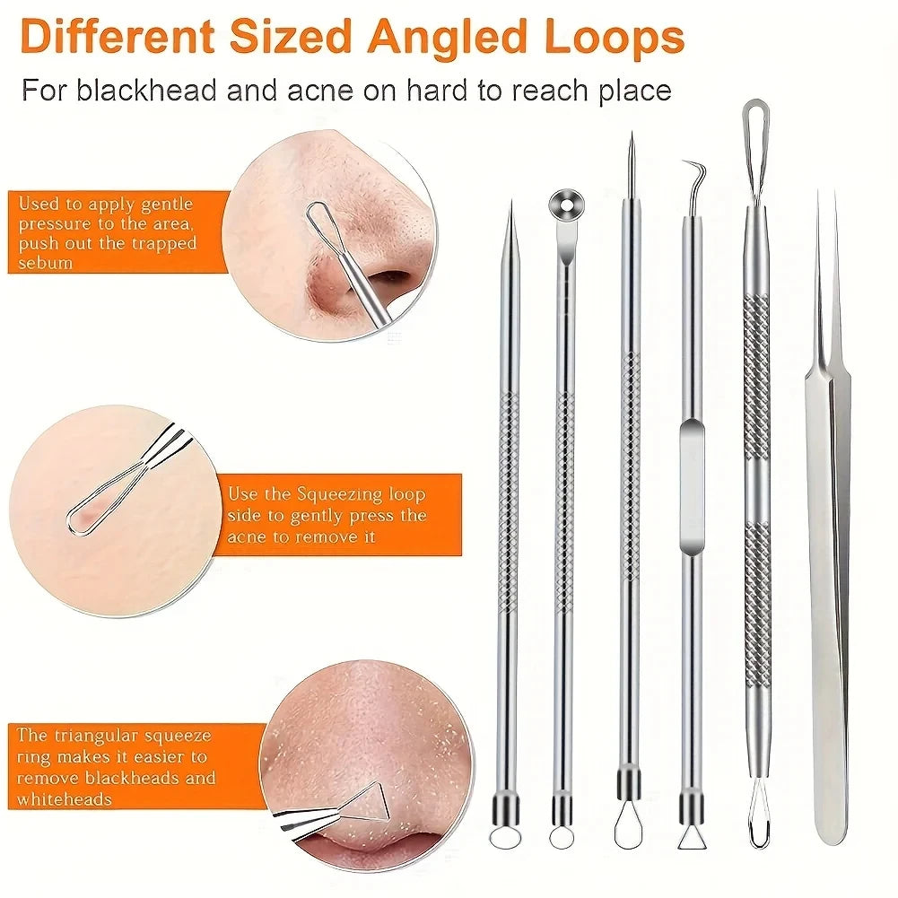 6 Piece Pimple Popper Tool Kit for Effective Acne Removal - Smarsty