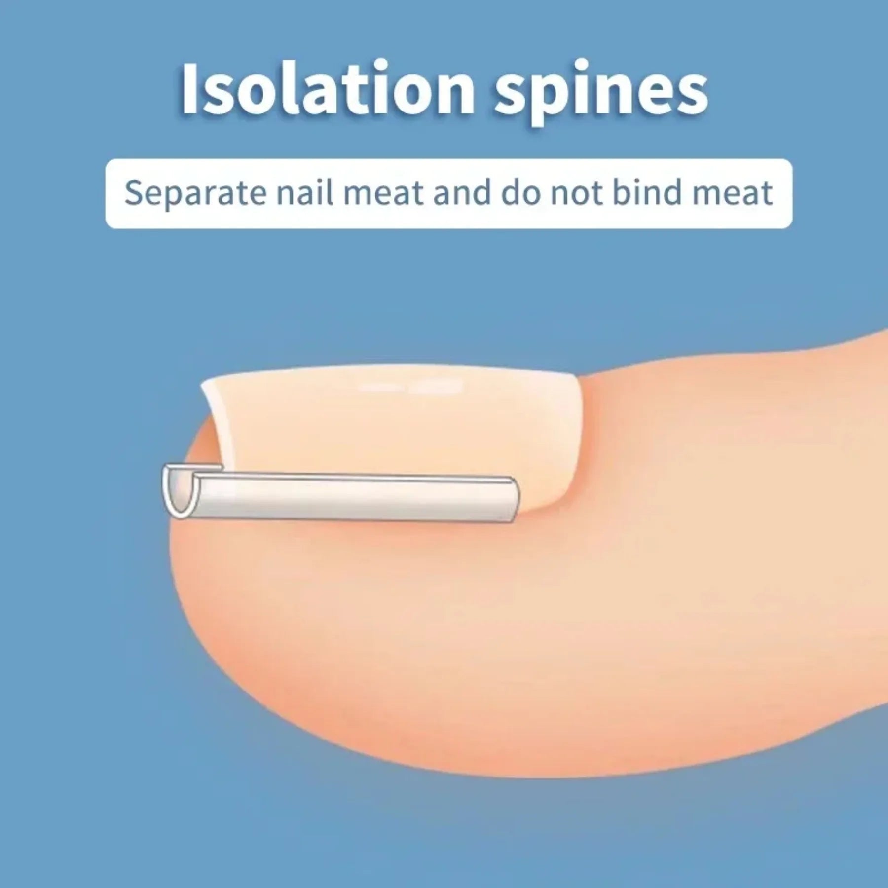 Ingrown Toenail Correction Tool Set for Effective Treatment - Smarsty