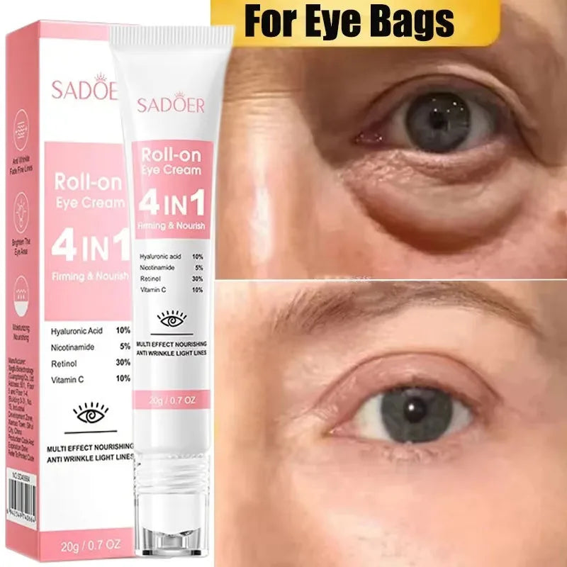 Instant Eye Bag Removal Cream for Dark Circles - Smarsty