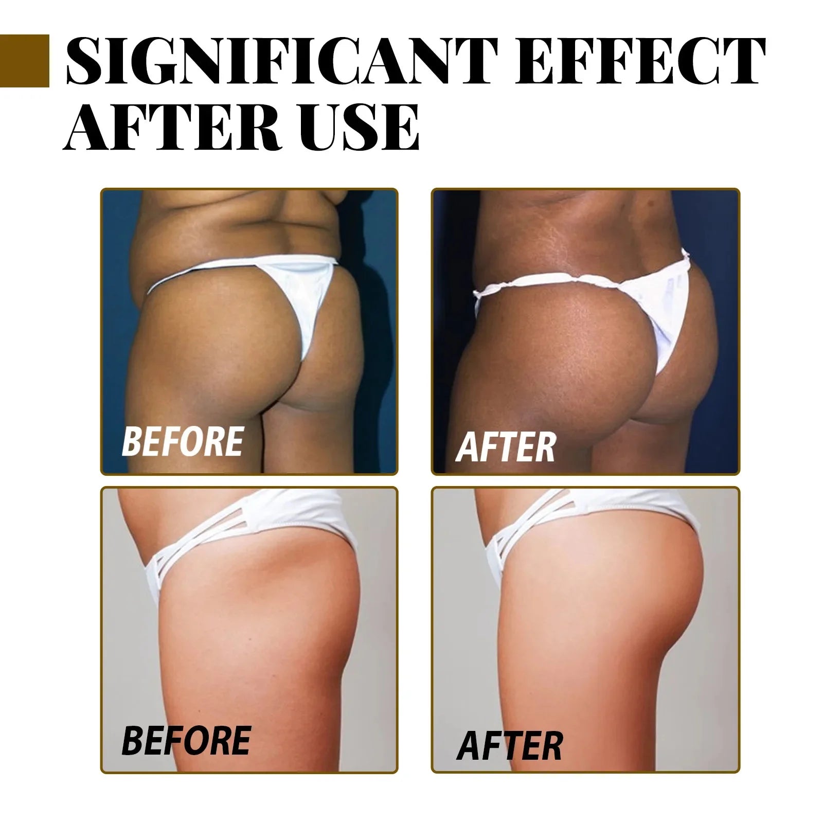 Butt Enhancement Essential Oil for Firming and Lifting - Smarsty