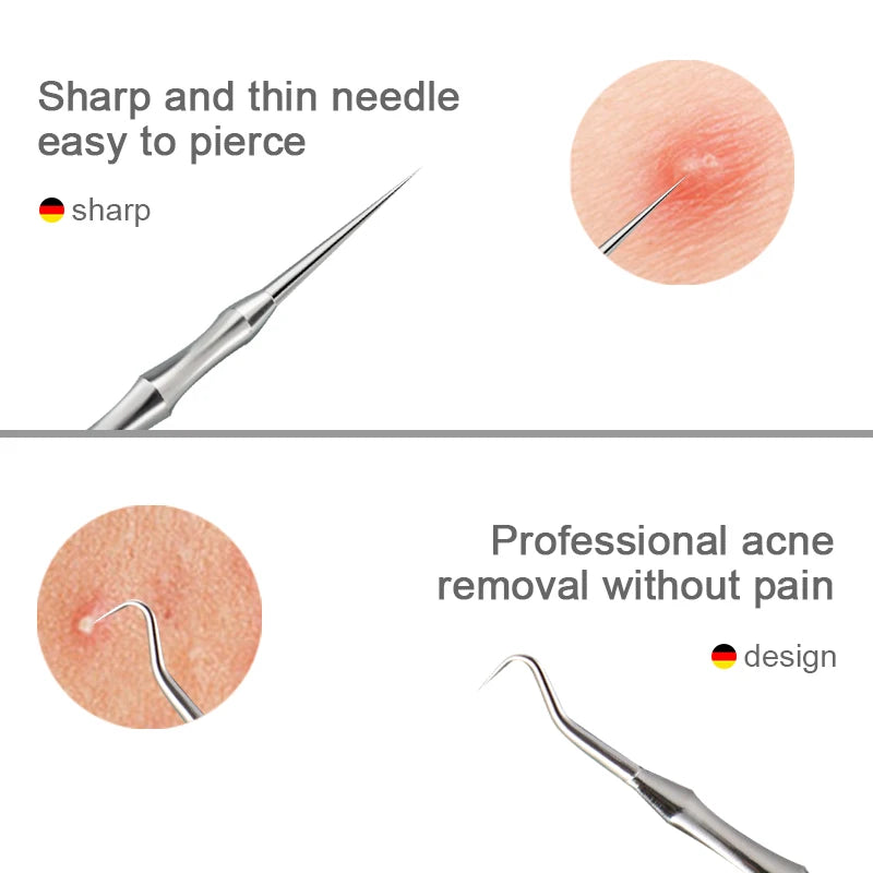 German Blackhead Removal Needle Tool for Clear Skin - Smarsty