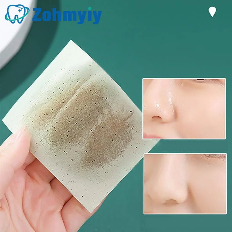 300Pcs Oil Control Blotting Papers for Clean Skin - Smarsty