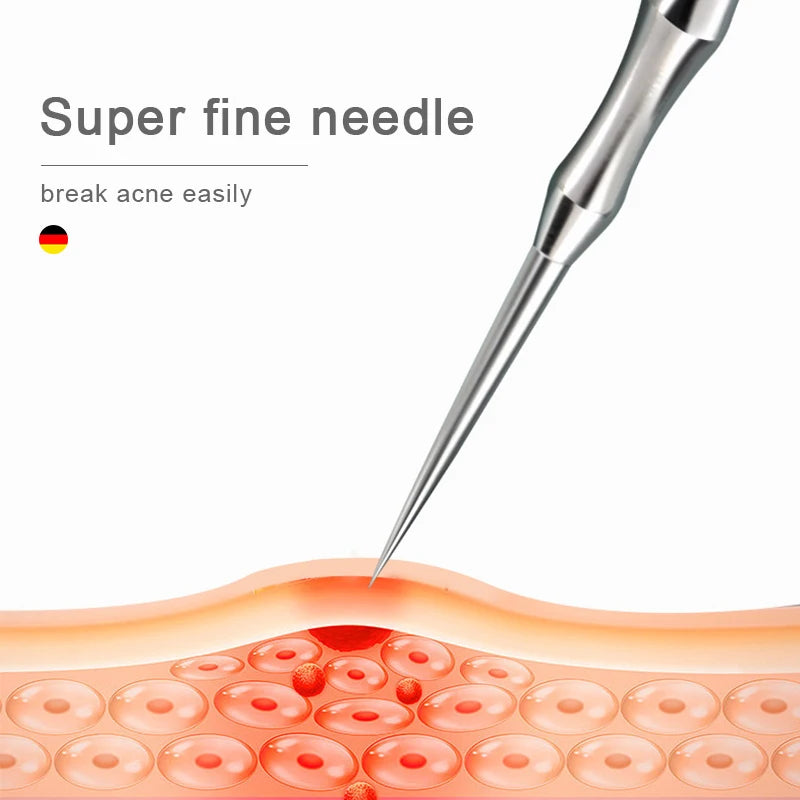 German Blackhead Removal Needle Tool for Clear Skin - Smarsty