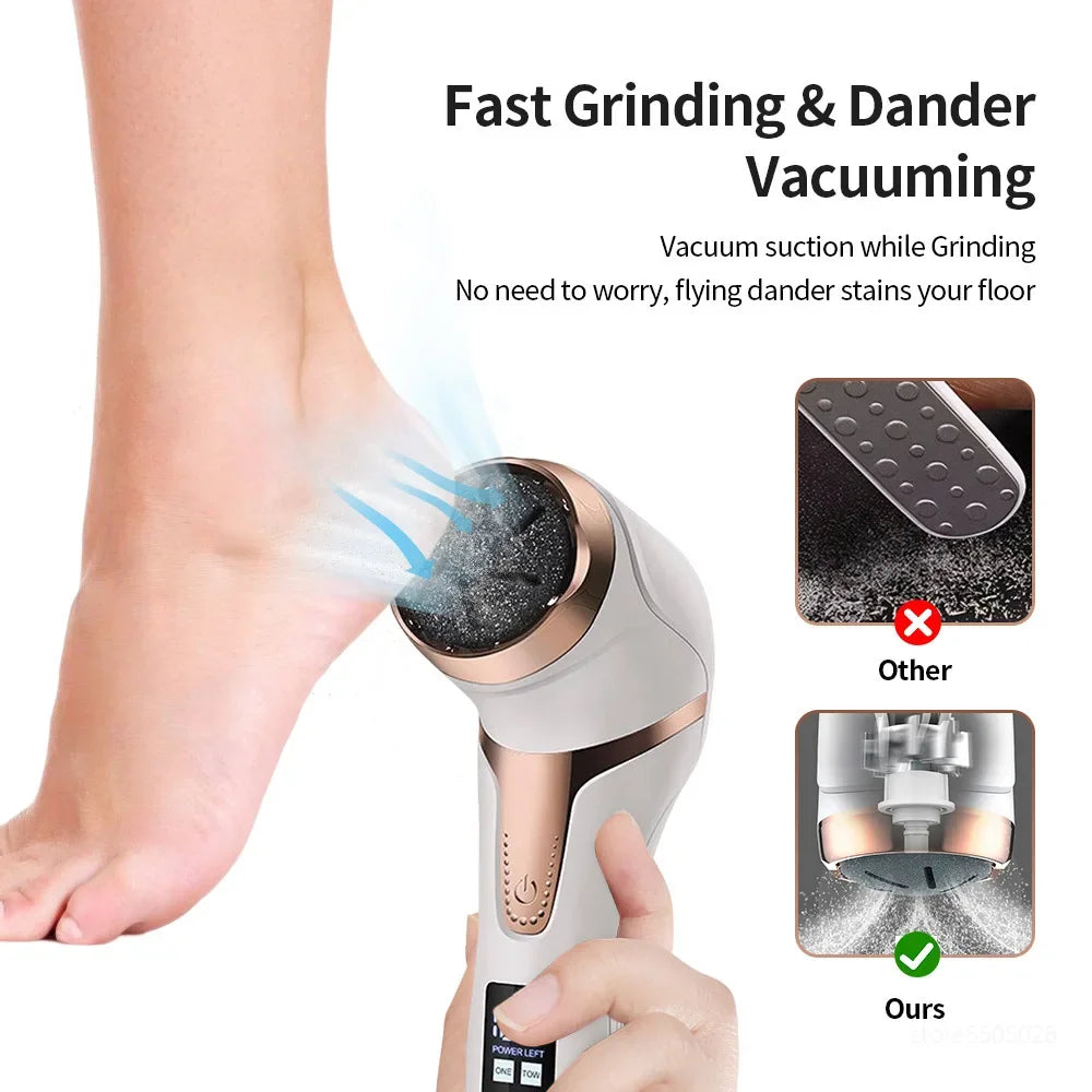 Rechargeable Electric Foot File Callus Remover for Smooth Feet - Smarsty