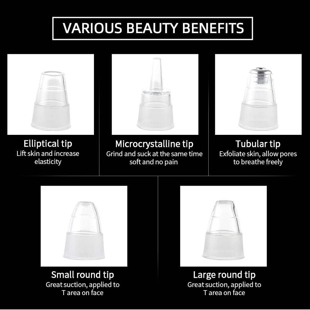 Vacuum Blackhead Remover With USB Charging Convenience - Smarsty