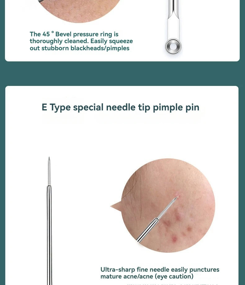 4 Piece Acne Blackhead Removal Needle Set - Smarsty